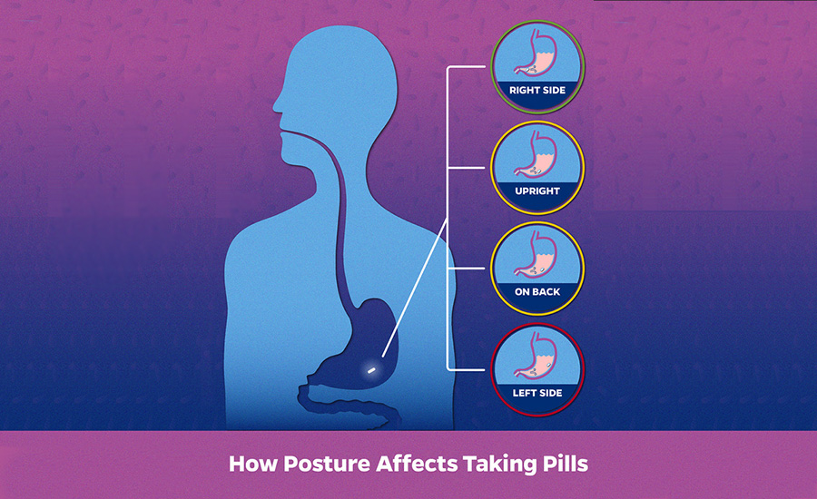 SCIBlog - 19 August 2022 - diagram of how posture affects medicine absorption