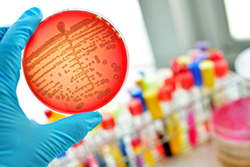 Food, water and pharma microbiology: - Rapid confirmation using MALDI-TOF II Tuesday 28 November 2017