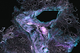 2nd SCI/RSC Fibrosis Medicinal Chemistry Symposium Friday 10 November 2017