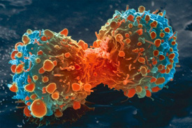 Cancer cell division.
