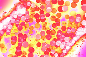 colloid