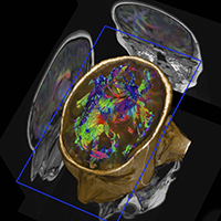 MRI Image