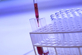 test tubes