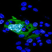 Virus Infected Cells