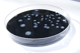 Waste water analysis