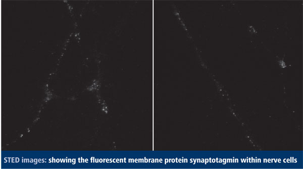 STED images