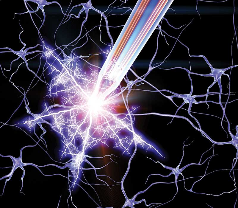 Illustration deep brain stimulation and nerve cells