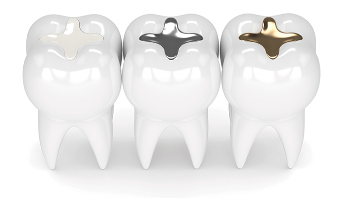 Chemistry and Industry - Issue 12, 2021 - image of filled teeth