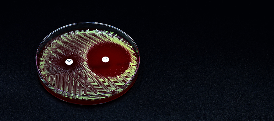 A microbiological culture Petri dish with bacteria where an antibiotic resistance test has been carried out