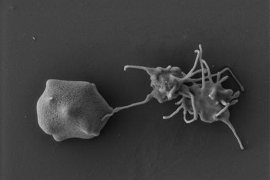 Electron microscopy image of a platelet binding to a red blood cell