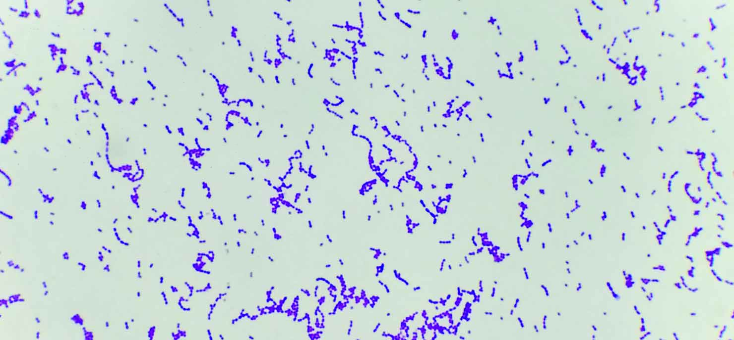 /-/media/images/cni/issue-image/2025/5/staphylococcus-aureus.ashx?h=687&w=1480&hash=F0A66FEC589D38B081FDE69ECA927CF5
