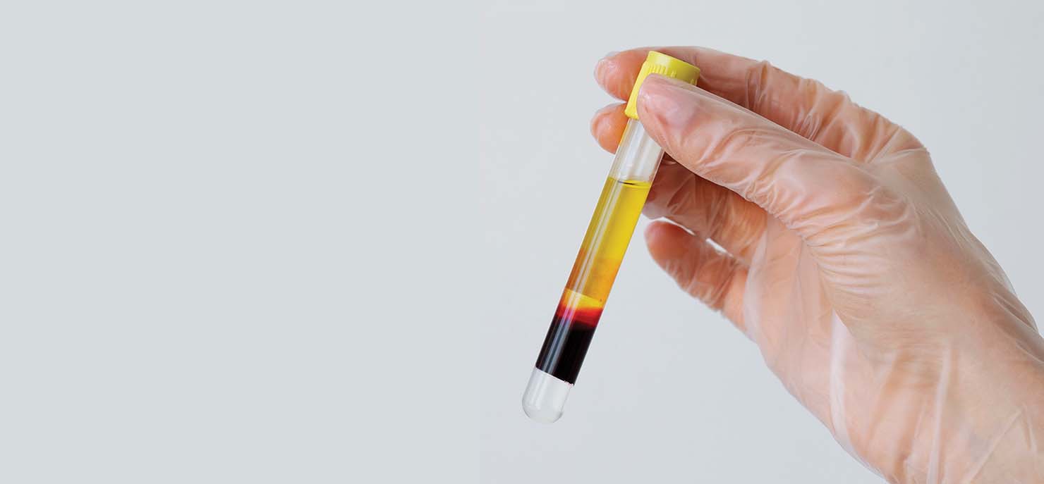/-/media/images/cni/issue-image/2025/7/gloved-hand-holding-vial.ashx?h=687&w=1480&hash=C3FC8733E6814CE1FF88B02863A52033