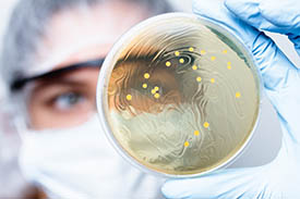 /-/media/images/general/b/bacteriapic.ashx?h=183&w=275&hash=814CC3C15489AC9BC357E7AEC2BAED99