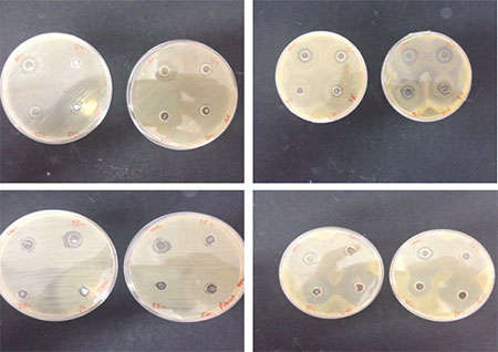 bacteria in honey