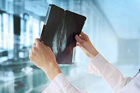 mammograph