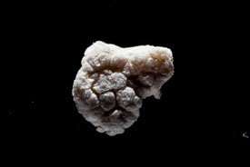 Microplastic fragment