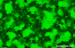 microscopic gel