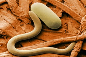 Colourised electron micrograph of soybean cyst nematode.