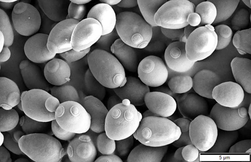 yeast cells