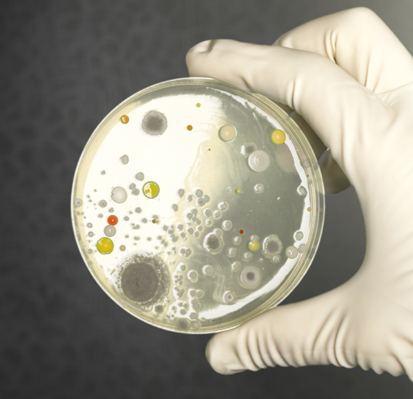 /-/media/images/news/2023/5/who_listing2.ashx?h=580&w=600&hash=0C06157C707BCC86E9329F360AE361F14AEE967A