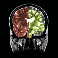 composite MRI image